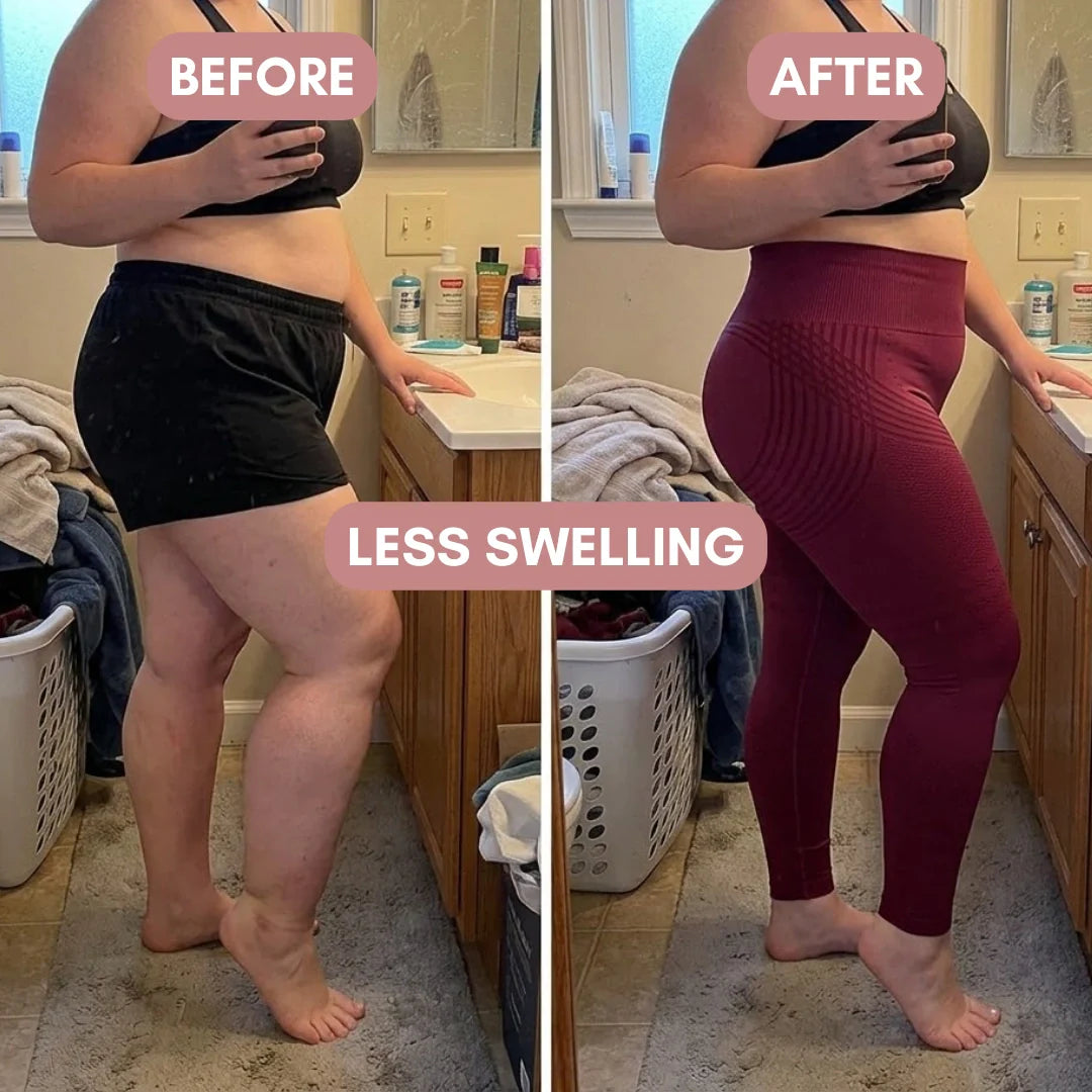 Naya 3D Legging – Say goodbye to lipoedema pain and swelling naturally