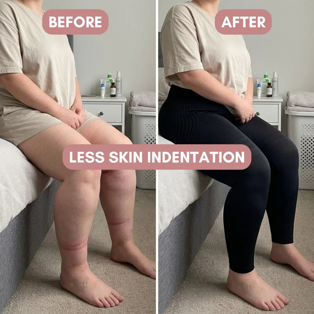 Naya 3D Legging – Say goodbye to lipoedema pain and swelling naturally