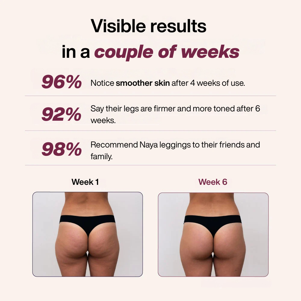 3D Anti-Cellulite Leggings